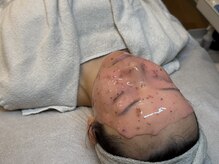 エルピス(ELPIS)/韓国肌管理/艶肌なりたい人！