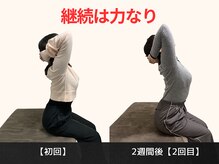 パルマ なかもず(Palma)/整体/頭痛/肩こり/ヘッドスパ