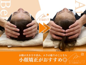 まいれ整骨院 大津市堅田院 マイレ 堅田店(MAILE)/小顔矯正ビフォーアフター