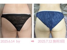 サロン ド 花歩 松山本店/美尻作りもお任せください♪
