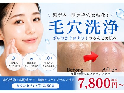 レフアの写真