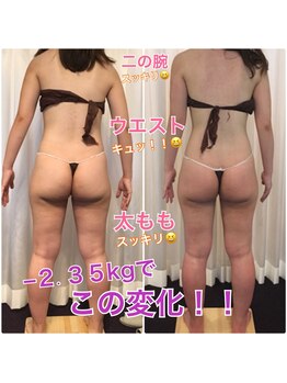 ボディエステティック アクアオーラ 富山店/ー２ｋｇでこの違い！