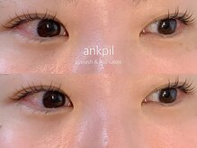 アノカプイル(ankpil)/【パリジェンヌ】