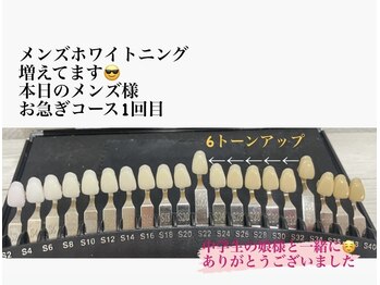 ピースドット 大村店(PEACE.)/メンズホワイトニング