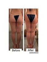 いおり骨盤整体 リブート(RE:BOOT)/セレクト痩身