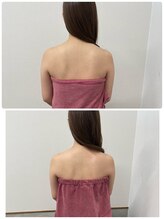 ブリランテ(Brillante)/体験beforeafter