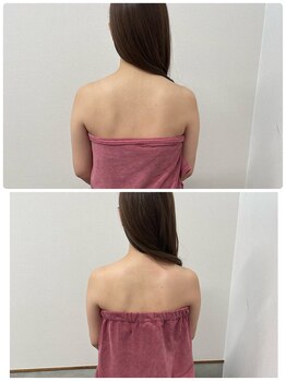 ブリランテ(Brillante)/体験beforeafter