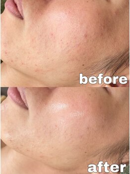 オアシス 岡崎(Oasis)/フェイシャルサロンOasis岡崎