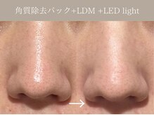 リィ プラス(Riii plus)/【毛穴ケアで敏感肌の方にも◎】