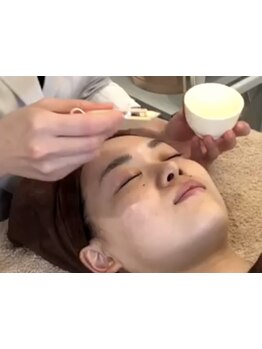 美白ケアをしたい