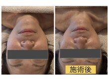 ドライヘッドスパとセットで効果を最大限に引き出します