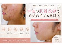 肌質改善サロン 姫路駅前店