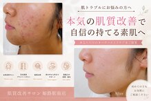 肌質改善サロン 姫路駅前店