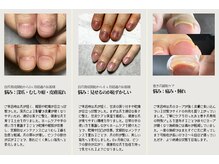 結(Yui)の雰囲気（お客様一人一人に合わせた自爪育成のプランやケア方法をご提供◎）