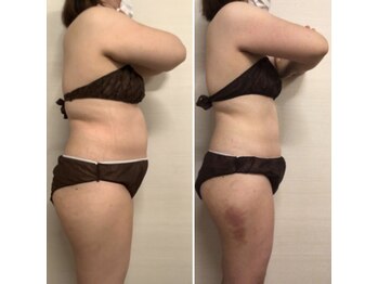 ジュメル 恵比寿店(Jumelles)/お肉のスジが気になり始めたら…