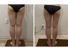 ラナビューティリゾート(Lana Beauty resort)/mayumi ★40代・4きろ減