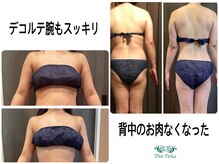 ディア フェリーチェ(Dea Felice)の雰囲気（3か月でこの結果/ブライダル/産後のダイエットにもおススメ）