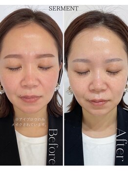 ザ ヴォーグ(the VOGUE)/ツヤ肌ならセルマン一択！