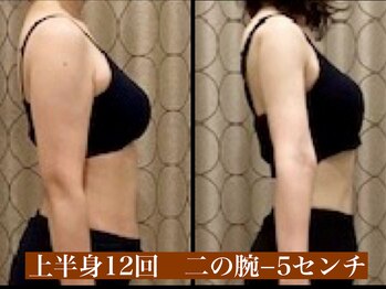 サロン セドナ(SALON SEDONA)/上半身リンパ痩身 12回コース