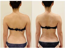 TMサロン 赤坂/姿勢/骨盤ゆがみも同時解消！