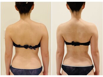 TMサロン 赤坂/姿勢/骨盤ゆがみも同時解消！