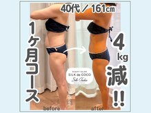 シルク ド ココ(Silk de Coco)/イヤーセラミック1ヶ月コース