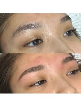 ジュリア(JULIA)/HBL（ハリウッドブロウリフト）