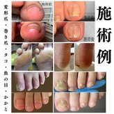 フットグレイス 恵比寿(foot grace)