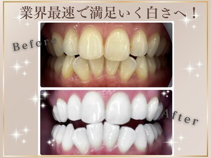 ラブホワイトニング 恵比寿店(LOVEホワイトニング)の写真