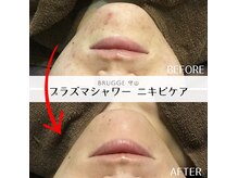 ブルージュ(Brugge)の雰囲気（結果が見える！最高水準のお手入れ★プラズマ美肌完結プログラム）