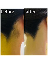 パーソナルエステティックサロン リボーン(ReBorn)/