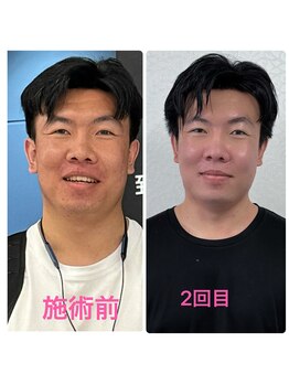 ハナノ整体院/イメージチェンジできた