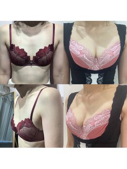 エスグレース 梅田店(S.grace)/ヘッドスパ痩身バストケアリンパ