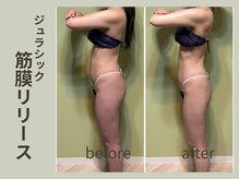 ジュラシック筋膜リリース！やみつきスッキリ感★