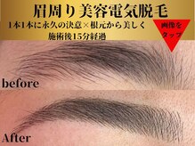 ベルアンドヘルス 千葉(BELL&HEALTH)/直後*眉は"美人の黄金バランス"