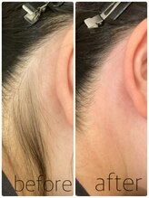 ニコプラス(NICO+)/