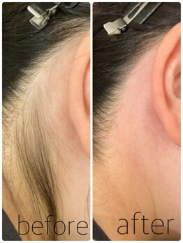 ニコプラス(NICO+)/