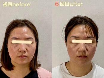 エスポワール(espoir)