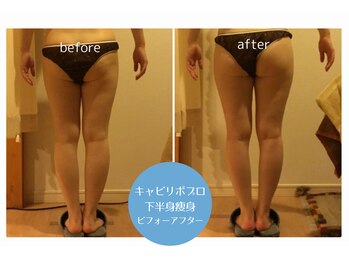 ボディデザインホームクレアフェリーチェ 神戸(Body design home Crea felice)/下半身痩身マシン・キャビリポ