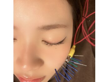 美容鍼・松山市　骨盤神経整体院【小顔矯正・肩こり・鍼治療】