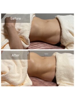 ミースリーズ(methrees)/お通じのお悩みにも【腸もみ】