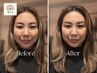 【隙間時間で心身リセット】45分 深圧ドライマッサージ＋極上炭酸ヘッドスパ