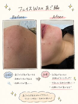 カロス(Calos)の写真/フェイスWaxはお肌がワントーン明るくなり、不要な角質も一緒にケアするので最短でツルツル美肌に♪