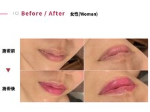 サンバイエム(#3/M)の雰囲気(ピンクトーン導入しました!色持ちを1年間キープするには4回必須)