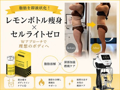 ミラヴィエ(Miravie)の写真