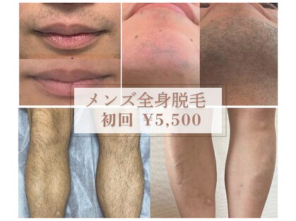 ビオラス(VIOLUS)の写真