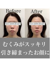 ハリサロンドオフ 心斎橋店(hari salon de off)/浮腫みがスッキリ♪