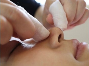 ラボーテヴェリテ(La Beaute Verite)の写真/【毛穴エクストラクション導入店】取れた角栓が見える最先端毛穴ケア★毛穴の黒ずみや詰まりを解消します！