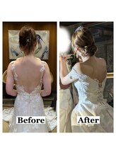 ライズ/お客様のビフォーアフター