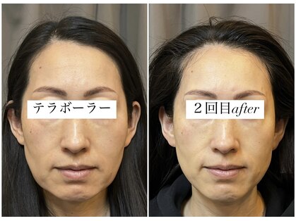 エピアンド(epi &…)の写真